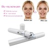 Acne pen med blåt lys terapi